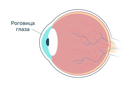 Роговица глаза