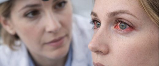 Красные белки глаз: причины, признаки и методы лечения покраснения