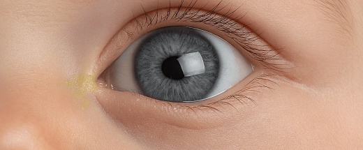 У ребенка гноятся глаза, что делать?